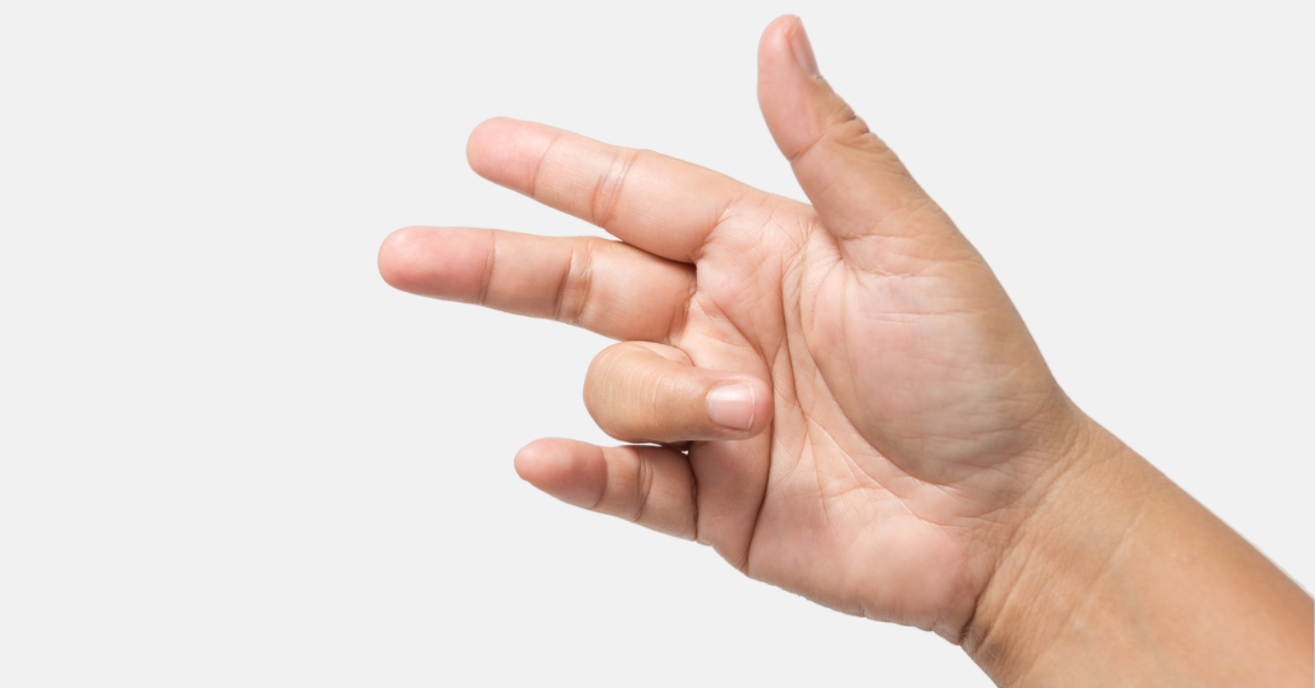 Symptoms and Treatment of Trigger Finger Diathrive